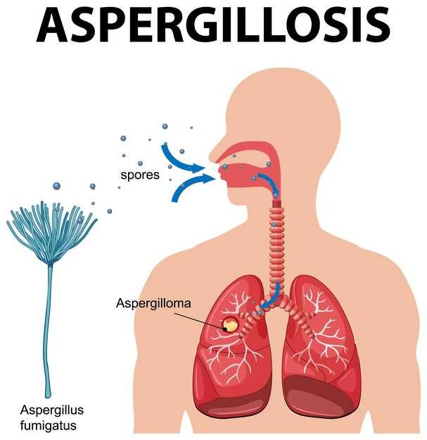 Azithromycin attenuates airway inflammation in a mouse model of viral bronchiolitis
