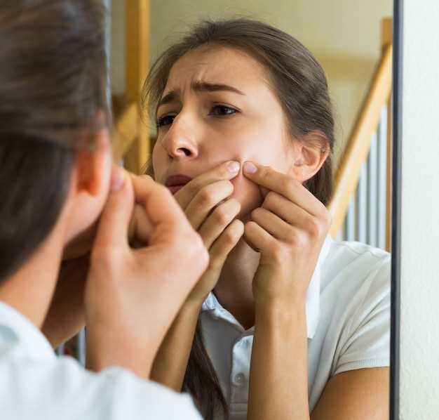 Azithromycin dosage in acne treatment