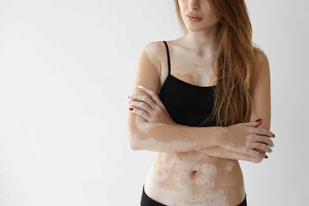 Azithromycin skin rashes