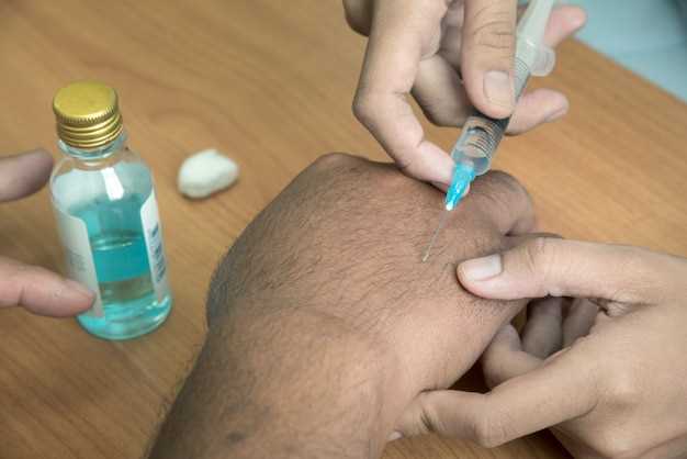 Can azithromycin treat folliculitis