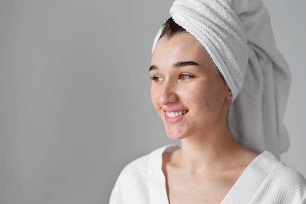 Can doxycycline cause pimples