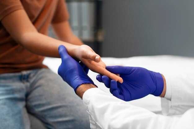 Does doxycycline cover strep