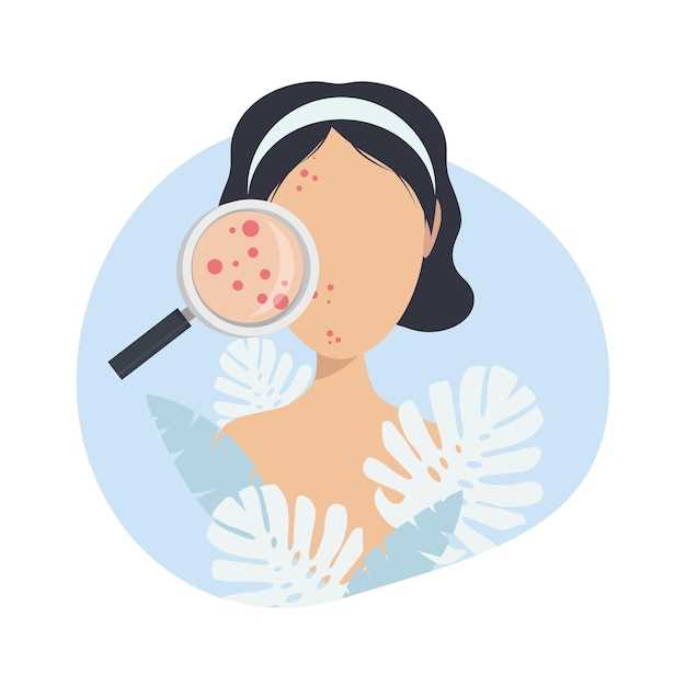 Does doxycycline help with rosacea