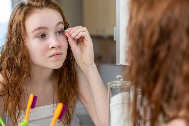 Does doxycycline treat pimples