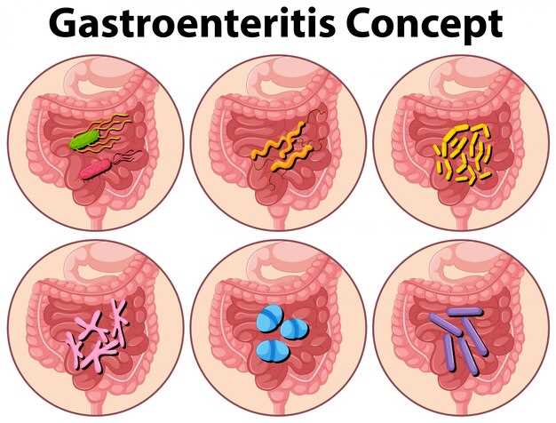 Doxycycline collitis