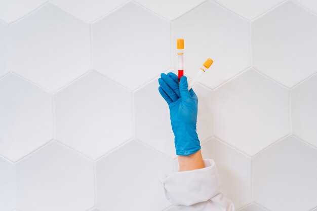 Doxycycline for chlamydia reviews