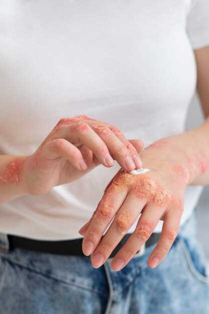 Rash on hands from doxycycline