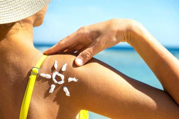 Sun exposure while taking doxycycline
