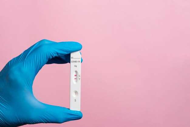 What is clonidine suppression test